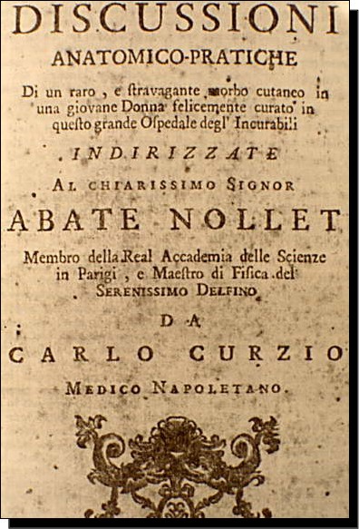 Fig 1. Facsimil del trabajo de Carlo Curzio